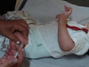 El Brote de sarampión levanta preocupaciones en EEUU